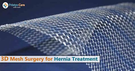 dr richard miller hernia mesh removal|Hernia Mesh Removal .